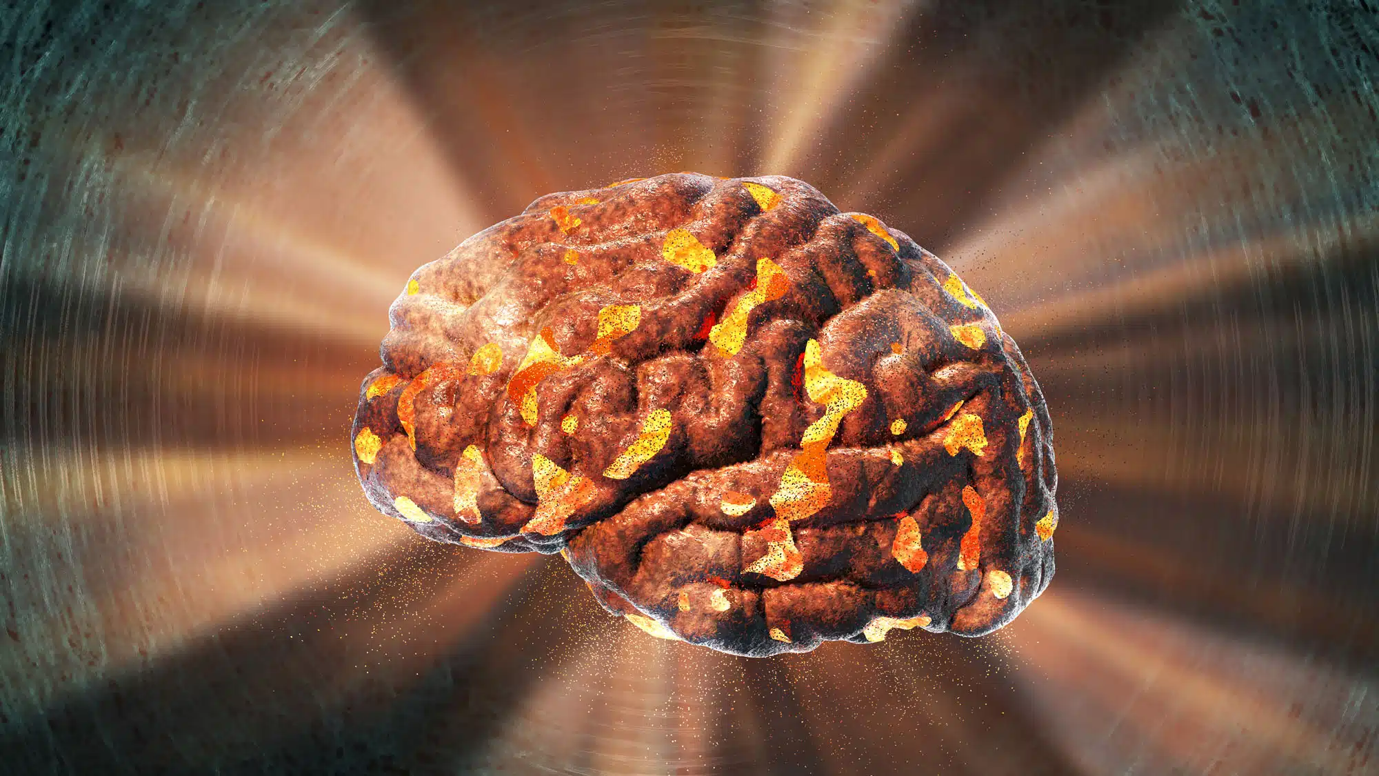 Abstract illustration of an altered human brain with glowing patterns